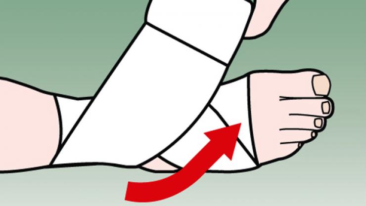 Hướng dẫn hỗ trợ bảo vệ cổ chân với băng cuốn thể thao